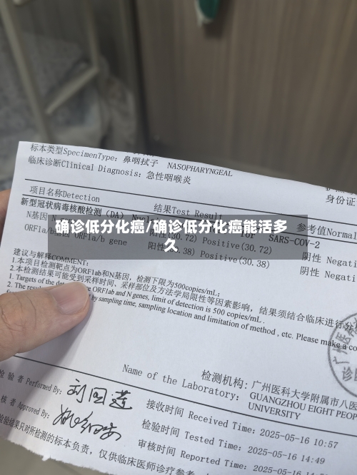 确诊低分化癌/确诊低分化癌能活多久